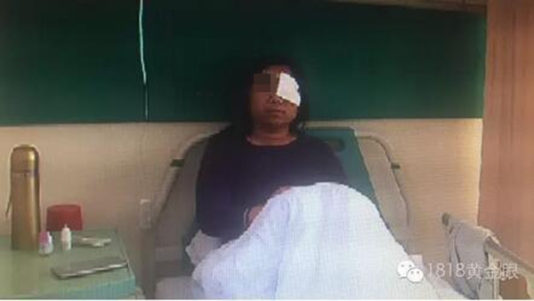 400元新買手機(jī)胸前爆炸起火 生產(chǎn)廠家是深圳公司