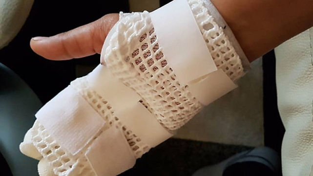 HTC旗艦手機(jī)爆炸傷人嚴(yán)重 官方沉默